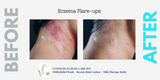 Organic Intensive Butter- Bakuchiol 2% + Hemp Seed + Evening Primrose (Dry Skin, Eczema & Psoriasis Care)