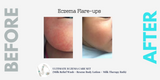 Soothing Milk Therapy Bath (Dry Skin, Eczema & Psoriasis Care)