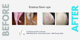 Organic Intensive Butter- Bakuchiol 2% + Hemp Seed + Evening Primrose (Dry Skin, Eczema & Psoriasis Care)