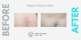 Organic Baby Balm Set (Nappy & Sleep)