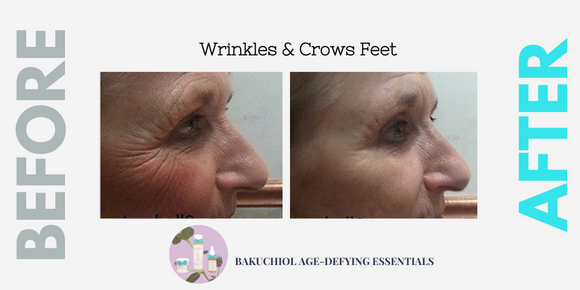 Anti-Aging Results From Bakuchiol Range (Compilation)